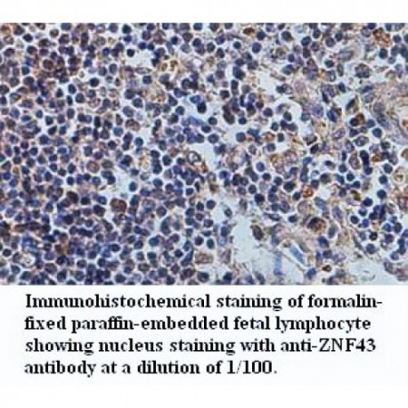 ANAPC2 Antibody