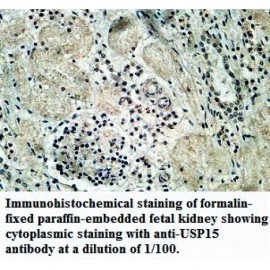 ZNF461 Antibody