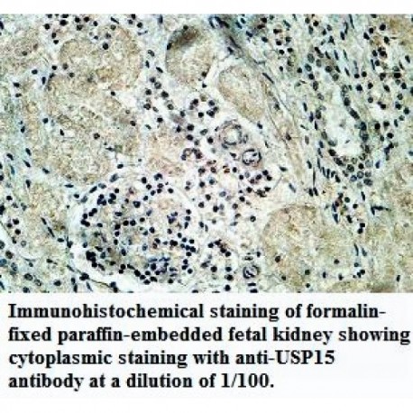 ZNF461 Antibody