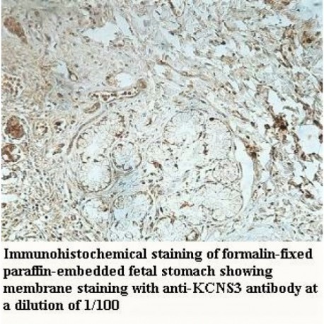 KCNS3 Antibody