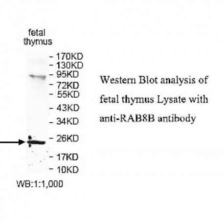 RAB8B Antibody