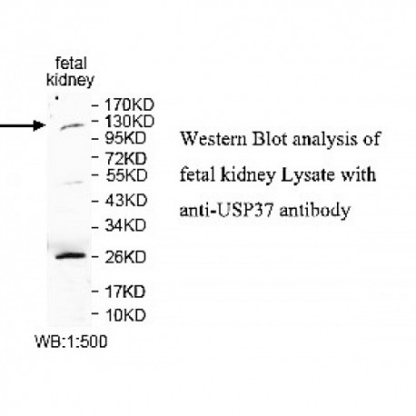 SUMO2 Antibody