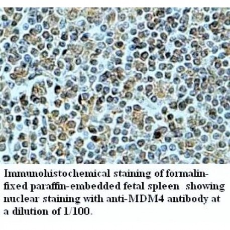 MDM4 Antibody