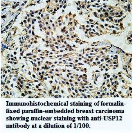 USP12 Antibody