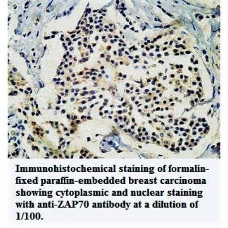 ZAP70 Antibody