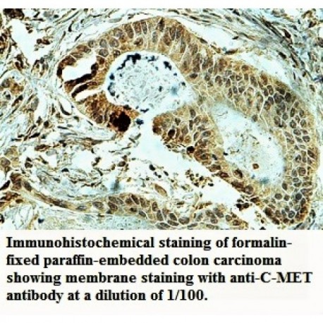 MET Antibody