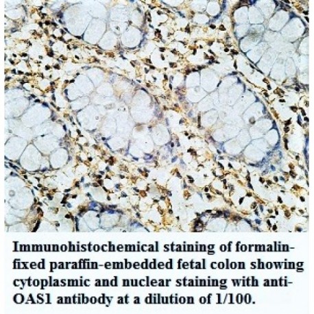 OAS1 Antibody