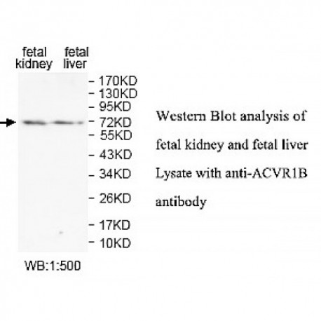 ACVR1B Antibody