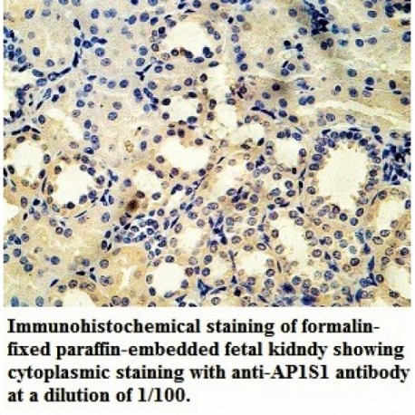 AP1S1 Antibody