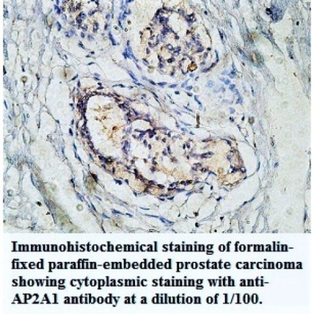 AP2A1 Antibody