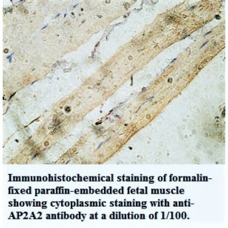 AP2B1 Antibody