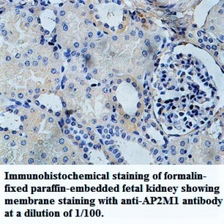 AP2M1 Antibody