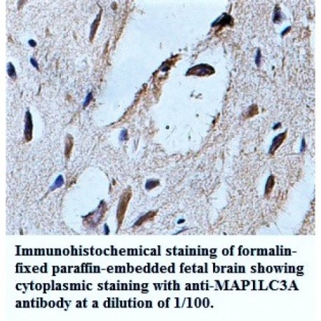 MAP1LC3A Antibody