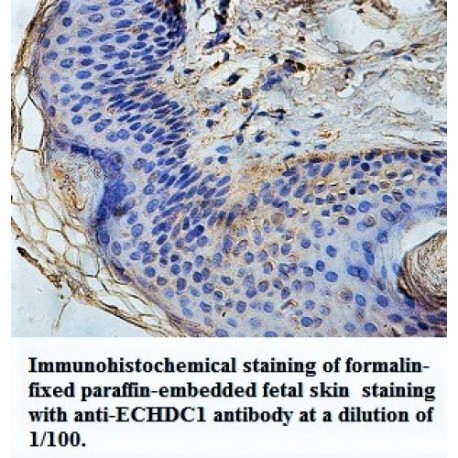 ECHDC1 Antibody