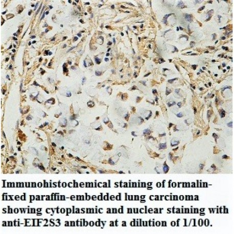 EIF2S3 Antibody