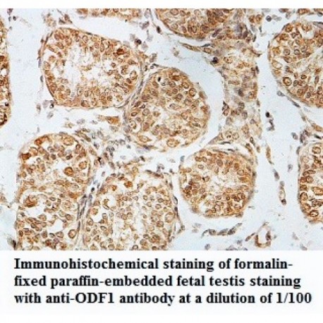 ODF1 Antibody