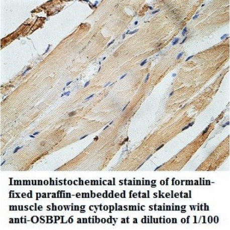 OSBPL6 Antibody