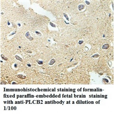 PLCB2 Antibody