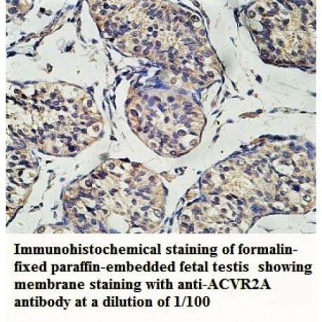 ACVR2A Antibody