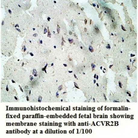 ACVR2B Antibody