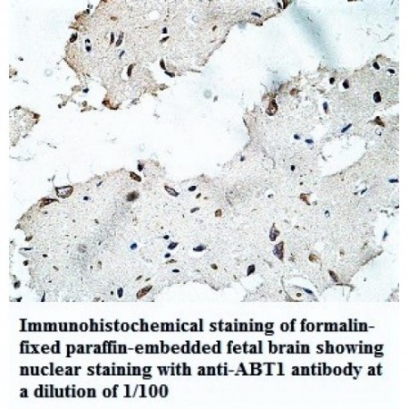 ABT1 Antibody