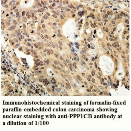 PPP1CB Antibody