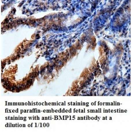 BMP15 Antibody