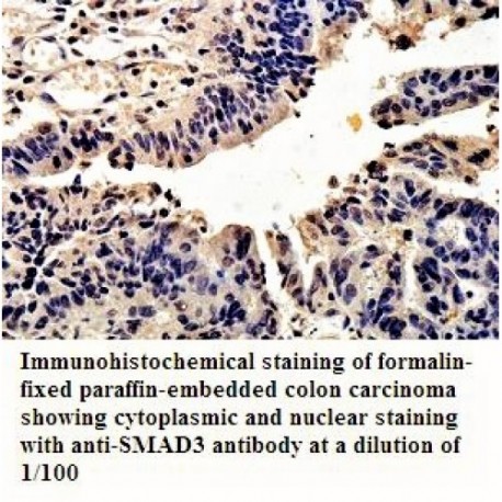 SMAD3 Antibody