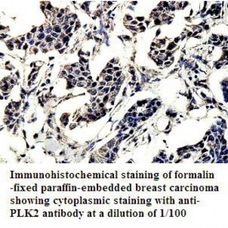 PLK2 Antibody