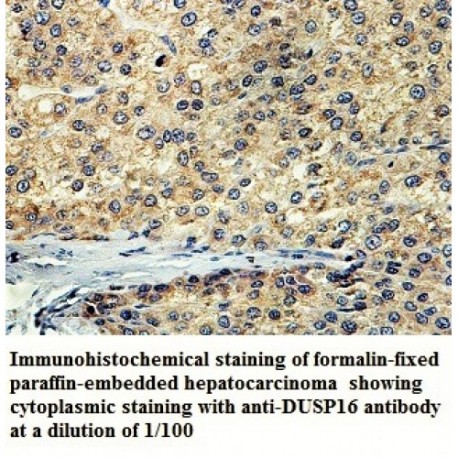 DUSP16 Antibody