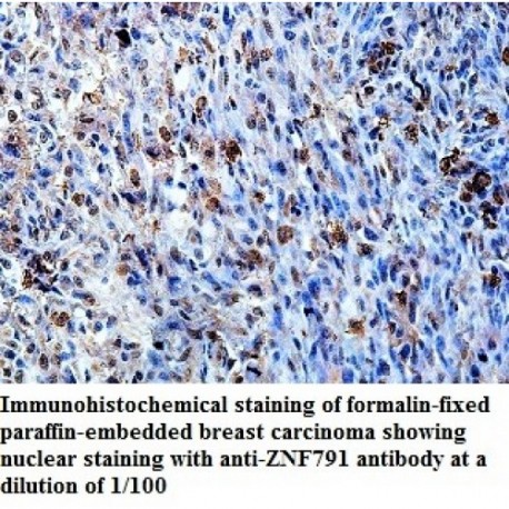 ZNF791 Antibody