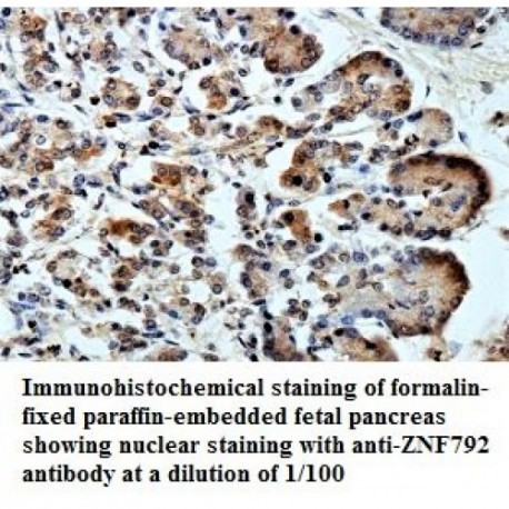 ZNF792 Antibody