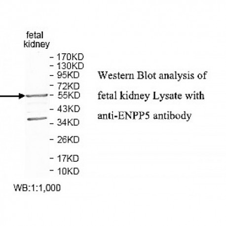 ENPP5 Antibody