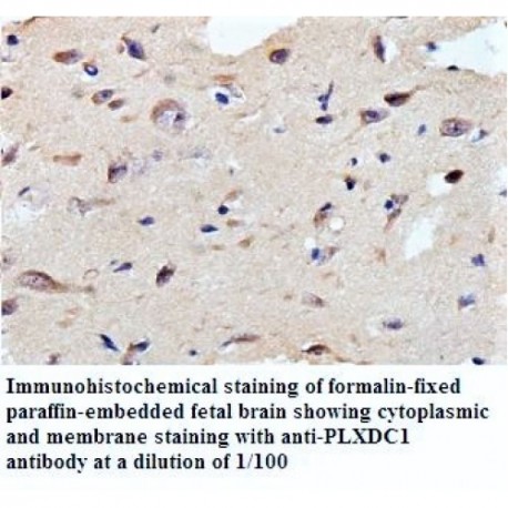 PLXDC1 Antibody