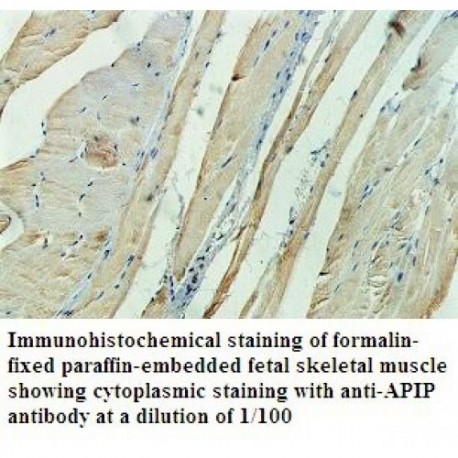 APIP Antibody