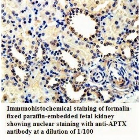 APTX Antibody