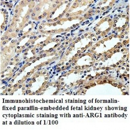 ARG1 Antibody