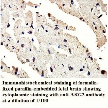 ARG2 Antibody