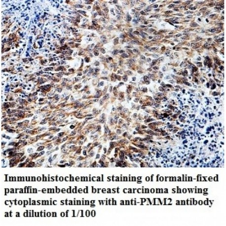 PMM2 Antibody