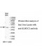 KLHDC2 Antibody