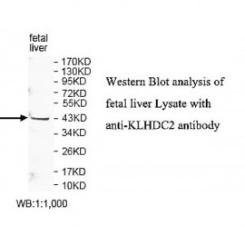 KLHDC2 Antibody