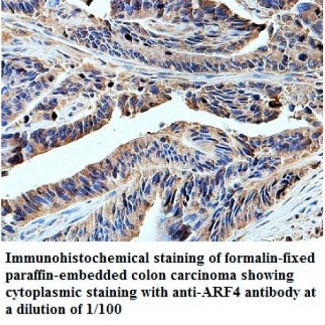 ARF4 Antibody