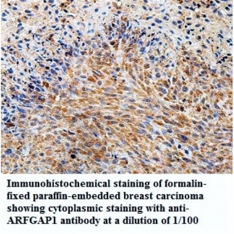 ARFGAP1 Antibody