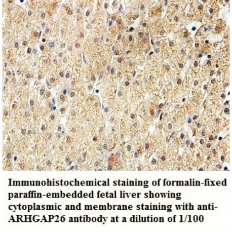 ARHGAP26 Antibody