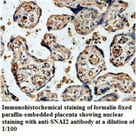 SNAI2 Antibody