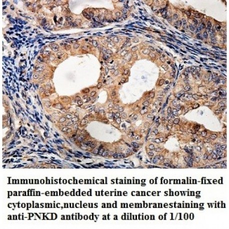 PNKD Antibody