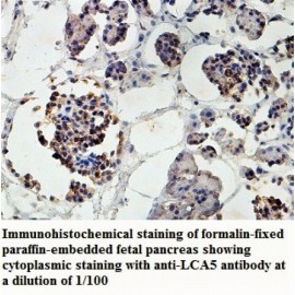 LCA5 Antibody