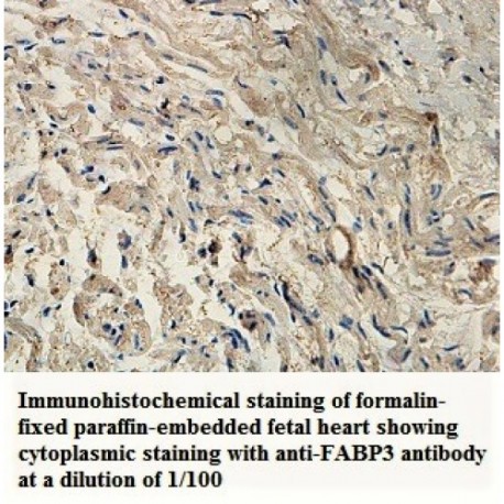 FABP3 Antibody