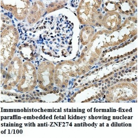 ZNF274 Antibody