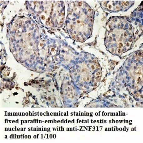 ZNF317 Antibody